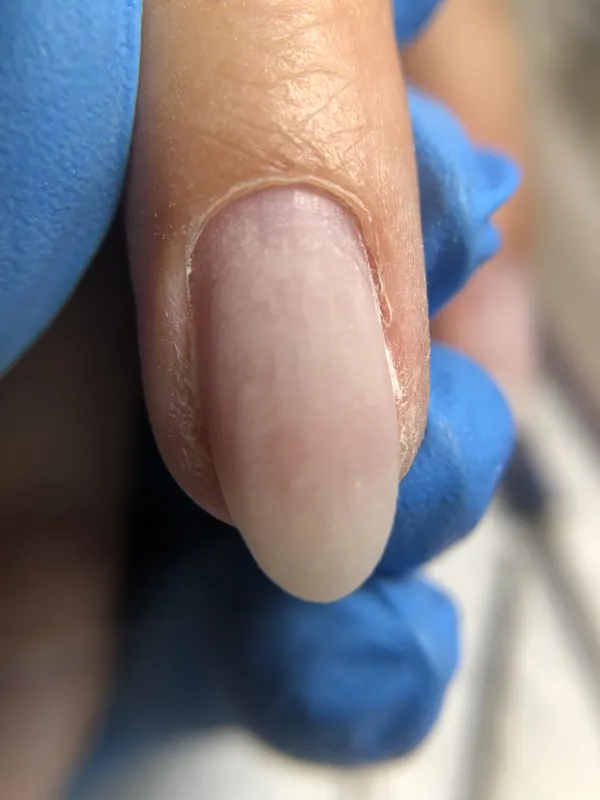 Antes: detalhe da cutícula antes do tratamento